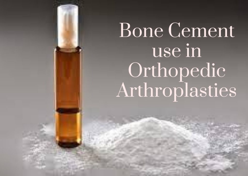 Notable risks in the use of bone cement Bone Cement Implantation